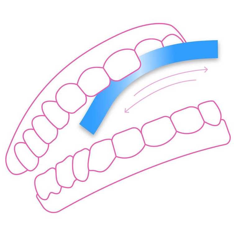 DrSmile IPR