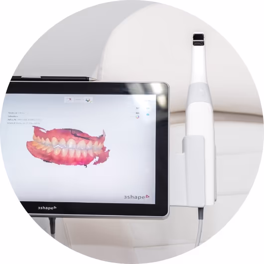 [CRO] Impress Quality & Technology Benefits - Precise Status Quo